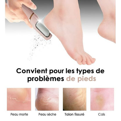 Extracteur de callosités électrique pour les pieds - Pédicure professionnelle à domicile.