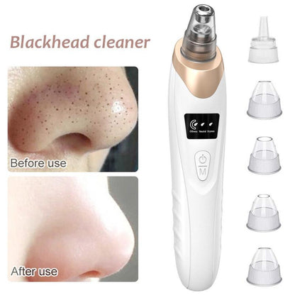 Aspirateur de points noirs | Nettoyant pour pores en profondeur | Aspiration réglable | Rechargeable | PureLure