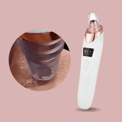 Aspirateur de points noirs | Nettoyant pour pores en profondeur | Aspiration réglable | Rechargeable | PureLure